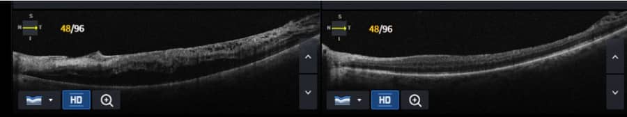 Slider image (8) Dr Nikolaos I Dervenis Eye Clinic